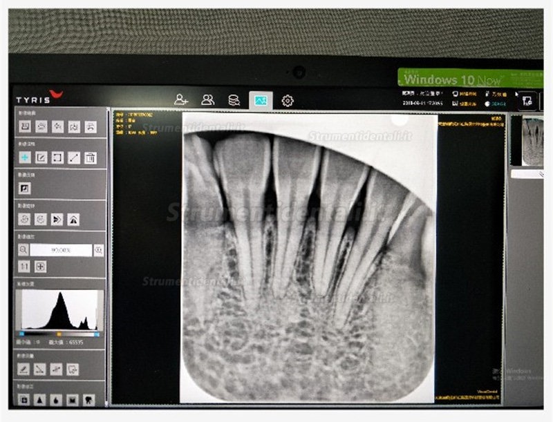 TYRIS TR-100 scanner ai fosfori scanner lastre di imaging intraorale dentale CR